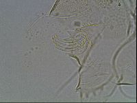 Testechiniscus laterculus image
