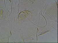 Testechiniscus laterculus image