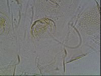Testechiniscus laterculus image