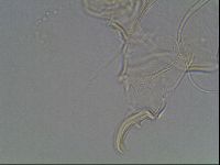 Testechiniscus laterculus image