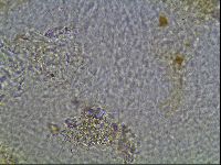 Testechiniscus laterculus image