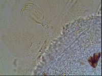 Testechiniscus laterculus image