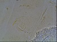 Testechiniscus laterculus image