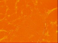 Testechiniscus laterculus image