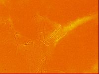Testechiniscus laterculus image