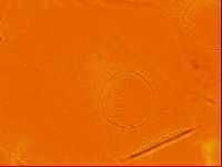 Testechiniscus laterculus image