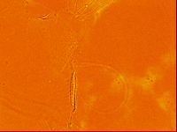 Testechiniscus laterculus image