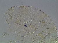 Testechiniscus laterculus image