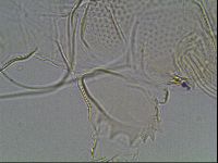 Testechiniscus laterculus image
