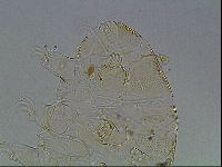 Testechiniscus laterculus image