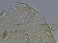 Testechiniscus laterculus image