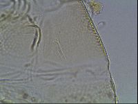 Testechiniscus laterculus image