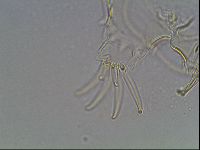 Testechiniscus laterculus image