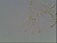 Testechiniscus laterculus image