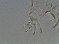 Testechiniscus laterculus image