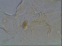 Testechiniscus laterculus image