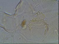 Testechiniscus laterculus image