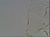 Testechiniscus laterculus image