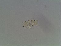 Testechiniscus laterculus image