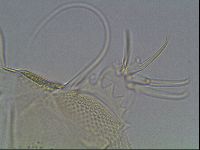 Testechiniscus laterculus image