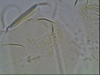 Testechiniscus laterculus image