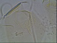 Testechiniscus laterculus image