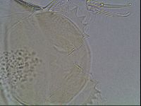 Testechiniscus laterculus image