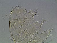 Testechiniscus laterculus image