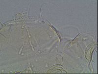 Testechiniscus laterculus image