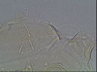 Testechiniscus laterculus image