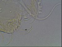 Testechiniscus laterculus image