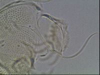 Testechiniscus laterculus image