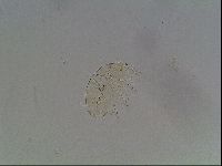 Testechiniscus laterculus image