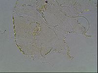 Testechiniscus laterculus image