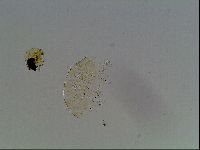 Testechiniscus laterculus image