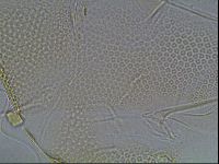 Testechiniscus laterculus image