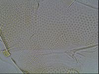Testechiniscus laterculus image