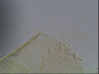 Testechiniscus laterculus image