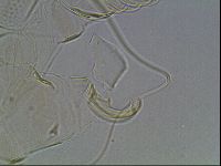 Testechiniscus laterculus image