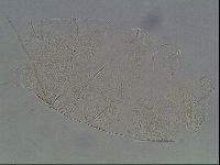 Testechiniscus laterculus image
