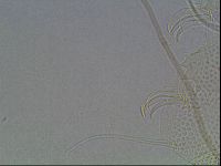 Testechiniscus laterculus image