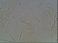 Testechiniscus laterculus image