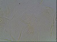 Testechiniscus laterculus image