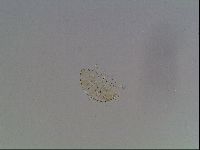 Testechiniscus laterculus image