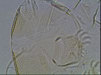 Testechiniscus laterculus image