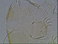 Testechiniscus laterculus image