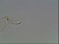 Testechiniscus laterculus image