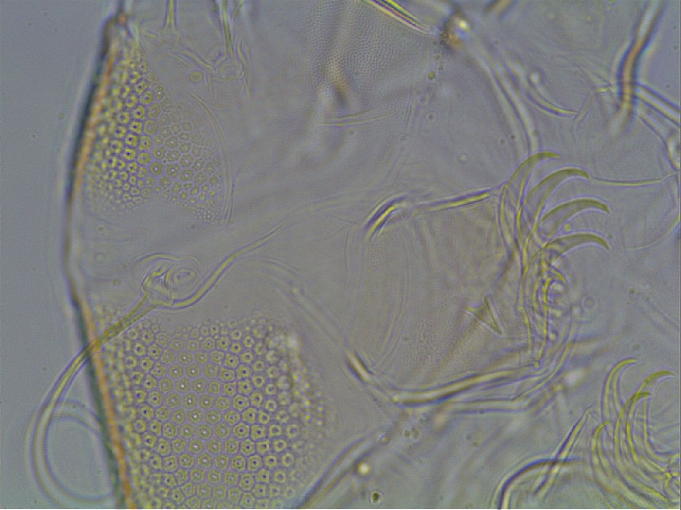 Testechiniscus laterculus image