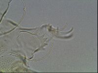 Testechiniscus laterculus image