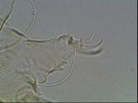 Testechiniscus laterculus image
